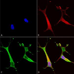 Immunocytochemistry/Immunofluorescence analysis of human neuroblastoma cells (SH-SY5Y), fixed in 4% PFA for 15  min, using Anti-ATP7B Antibody [S62-29] (A304969), at 1:100 for overnight at 4 °C with slow rocking.