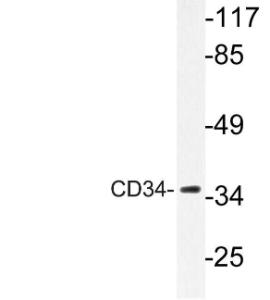 Western blot analysis of lysate from HepG2 cells using Anti-CD34 Antibody