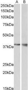 Anti-WNT9B Antibody (A84683) (1 µg/ml) staining of Mouse Kidney (A) and Brain (B) lysate (35 µg protein in RIPA buffer) Primary incubation was 1 hour Detected by chemiluminescence