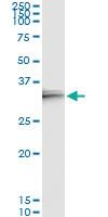 Anti-IL24 Antibody Pair