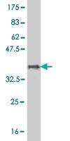 Anti-MARCH7 Mouse Monoclonal Antibody [clone: 2B9]