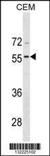 Anti-BMP8A Rabbit Polyclonal Antibody