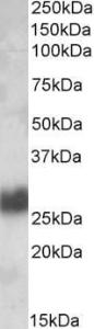 Anti-THY1 antibody