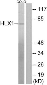 Western blot analysis of lysates from COLO205 cells using Anti-HLX1 Antibody. The right hand lane represents a negative control, where the antibody is blocked by the immunising peptide