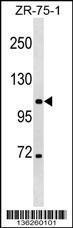 Anti-CLCN3 Rabbit Polyclonal Antibody (AP (Alkaline Phosphatase))