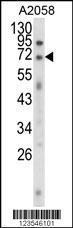 Anti-EWSR1 Rabbit polyclonal antibody