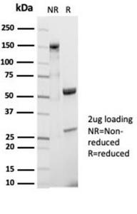 SDS-PAGE analysis of Anti-CD20 Antibody [IGEL/7015R] under non-reduced and reduced conditions; showing intact IgG and intact heavy and light chains, respectively. SDS-PAGE analysis confirms the integrity and purity of the Antibody