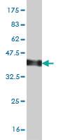 Anti-DMPK Mouse Monoclonal Antibody [clone: 2F7]