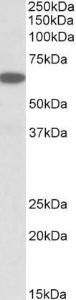 Anti-PLA2G4C Antibody (A83095) (0.03 µg/ml) staining of Human Pancreas lysate (35 µg protein in RIPA buffer). Primary incubation was 1 hour. Detected by chemilu minescence