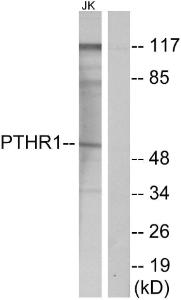 Western blot analysis of lysates from Jurkat cells using Anti-PTHR1 Antibody. The right hand lane represents a negative control, where the Antibody is blocked by the immunising peptide