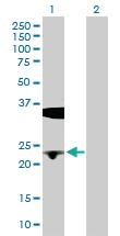 Anti-BLVRB Rabbit Polyclonal Antibody