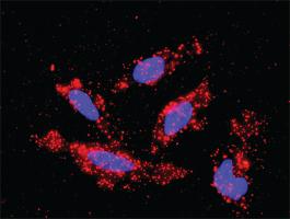 Anti-MAP3K1 Mouse Monoclonal Antibody [clone: 2F6]