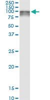 Anti-PMEL Polyclonal Antibody Pair