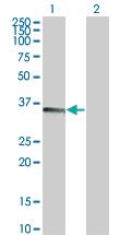 Anti-TNFSF13B Mouse Monoclonal Antibody [clone: 1C11]