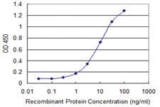 Anti-VAC14 Mouse Monoclonal Antibody [clone: 3B2]