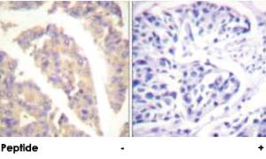 Anti-CBL Rabbit Polyclonal Antibody