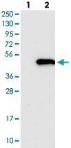 Anti-GTPBP10 Rabbit Polyclonal Antibody