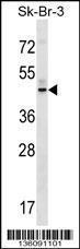 Anti-GPR87 Rabbit Polyclonal Antibody (HRP (Horseradish Peroxidase))