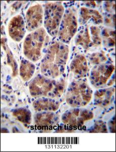 Anti-MAN2A2 Rabbit Polyclonal Antibody