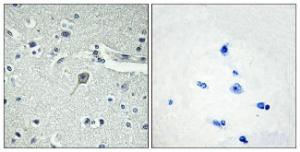 Immunohistochemical analysis of paraffin-embedded human brain tissue using Anti-PTHR1 Antibody. The right hand panel represents a negative control, where the Antibody was pre-incubated with the immunising peptide