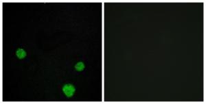 Immunofluorescence analysis of MCF7 cells using Anti-HLX1 Antibody. The right hand panel represents a negative control, where the antibody was pre-incubated with the immunising peptide