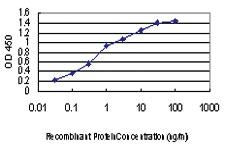 Anti-MAP3K1 Mouse Monoclonal Antibody [clone: 2F6]