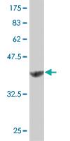 Anti-NUDT1 Mouse Monoclonal Antibody [clone: 5F11]