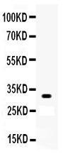 Anti-OTX2 Rabbit Polyclonal Antibody