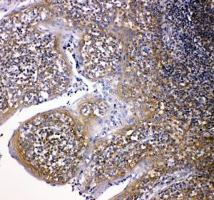 Anti-NOX2/gp91phox Rabbit Polyclonal Antibody