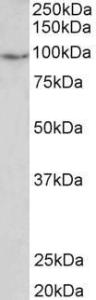 Antibody anti-PDE4B A83098-100 100 µg