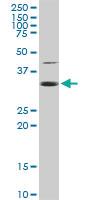 Anti-EEF1D Rabbit Polyclonal Antibody