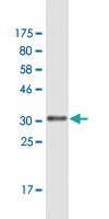 Anti-MARCH7 Mouse Monoclonal Antibody [clone: 4G3]