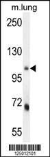 Anti-MLXIP Rabbit Polyclonal Antibody (AP (Alkaline Phosphatase))