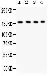 Anti-PLCB1 Rabbit Polyclonal Antibody