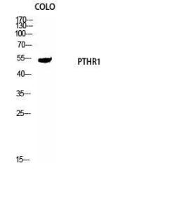 Western blot analysis of COLO cells using Anti-PTHR1 Antibody