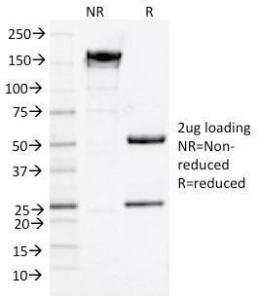 SDS-PAGE analysis of Anti-p75 NGF Receptor Antibody [NGFR/1964] under non-reduced and reduced conditions; showing intact IgG and intact heavy and light chains, respectively. SDS-PAGE analysis confirms the integrity and purity of the antibody.