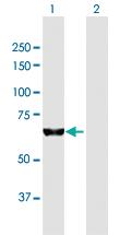 Anti-PUM3 Mouse Polyclonal Antibody