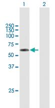 Anti-TSEN2 Mouse Polyclonal Antibody