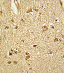 Anti-CBS Rabbit Polyclonal Antibody (PE (Phycoerythrin))