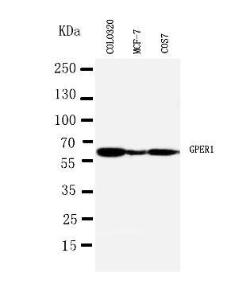 Anti-G-protein coupled Receptor 30 Rabbit Antibody