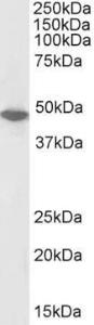 Anti-ORC4 Antibody (A83099/Biotin) (01 µg/ml) staining of Jurkat nuclear lysate (35 µg protein in RIPA buffer)