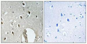 Immunohistochemical analysis of paraffin-embedded human brain using Anti-HLX1 Antibody 1:100 (4°C overnight). The right hand panel represents a negative control, where the antibody was pre-incubated with the immunising peptide