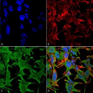 Immunocytochemistry/Immunofluorescence analysis of human neuroblastoma cell line (SK-N-BE, fixed in 4% formaldehyde for 15  min at room temperature, using Anti-NrCAM Antibody [S364-51] (A304970), at 1:100 for 60  minutes at room temperature.