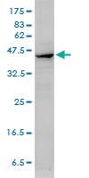 Anti-ACTA2 Mouse Monoclonal Antibody [clone: 4A8-2H3]