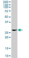 Anti-EEF1D Rabbit Polyclonal Antibody