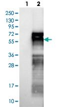 Anti-GPBP1L1 Rabbit Polyclonal Antibody