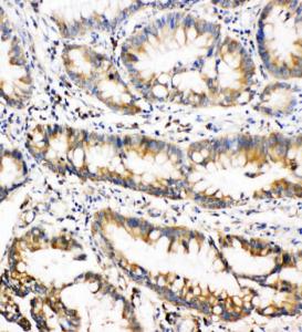 Anti-Oncostatin M Rabbit Polyclonal Antibody