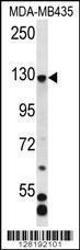 Anti-C7orf63 Rabbit Polyclonal Antibody (HRP (Horseradish Peroxidase))