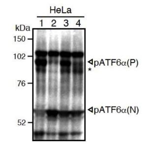 Anti-ATF6 antibody