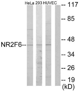 Anti-NR2F6 Rabbit Polyclonal Antibody